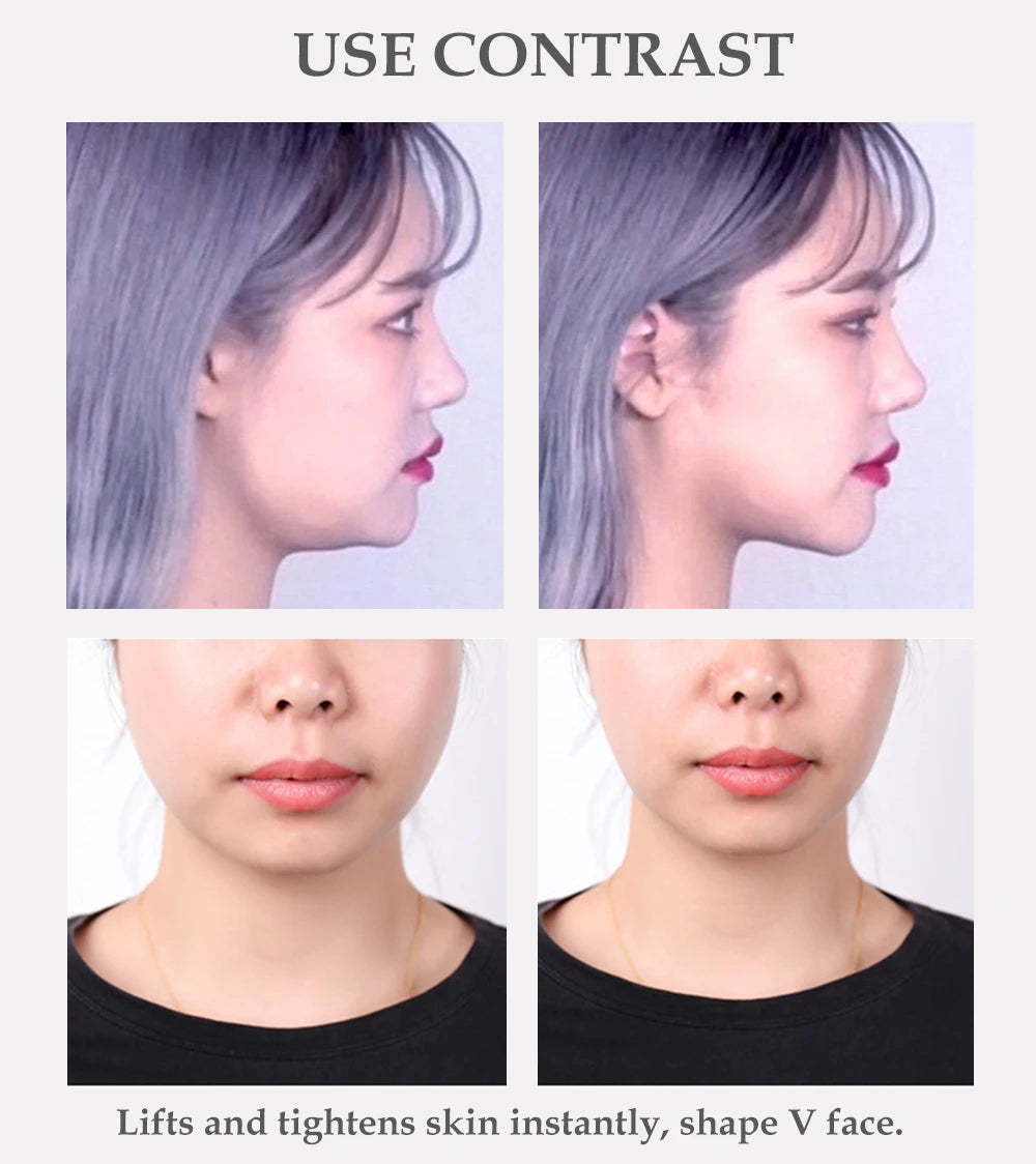 Before and after comparison of invisible face-lifting adhesive patches used to tighten skin and define the jawline.