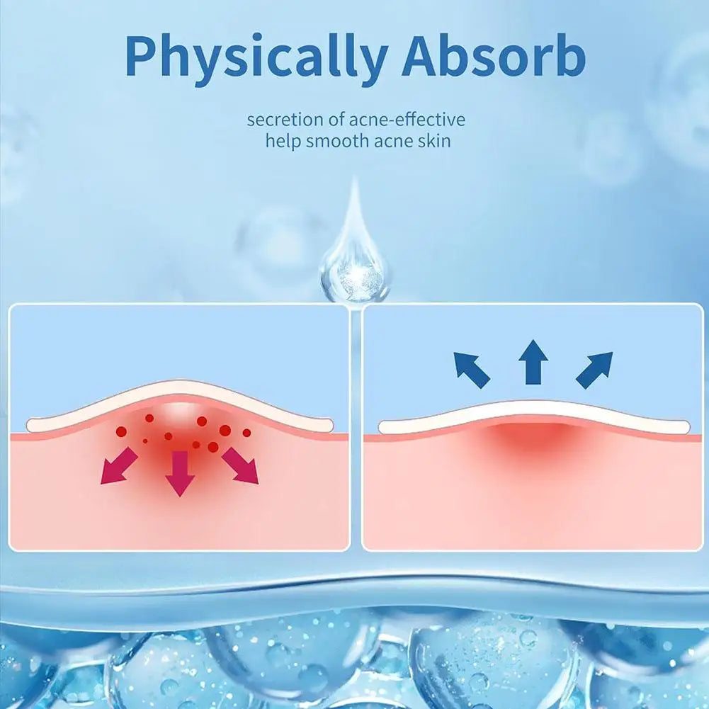 200/262/360pcs Salicylic Acid Acne Patches Mild Non-irritating Fade Black Acne Marks Facial Care Patches Acne Closure Removal