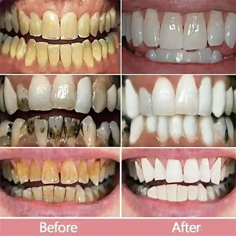 Tidesmit 2026 whitening toothpaste for effective yellow teeth removal and daily oral hygiene teeth cleaning