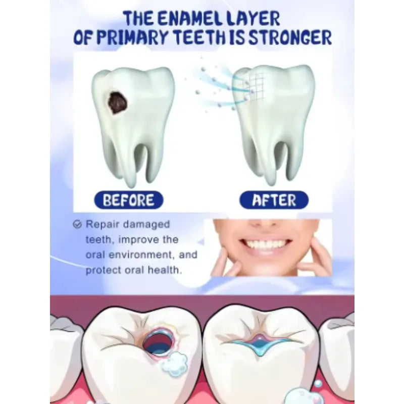 Tidesmit teeth whitening and cavity repair treatment for tooth decay protection and enamel restoration