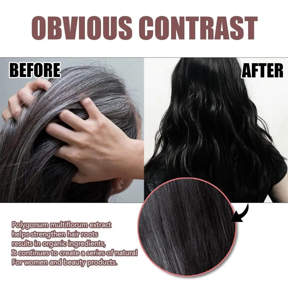 Polygonum Hair Darkening Shampoo Soap Bar Repair Gray White Hair Color To Black Shampoo Soap Hair Nourishing Shampoo Soap Bar
