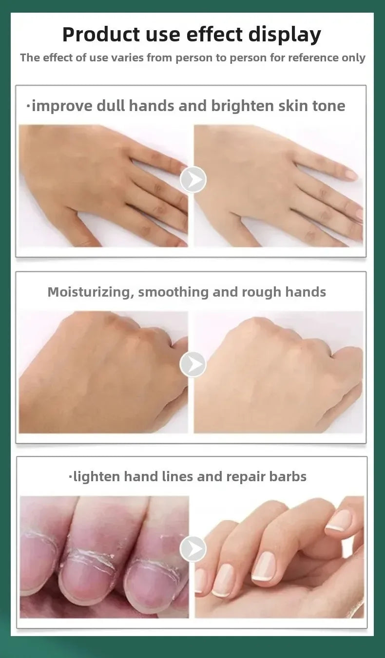 Hand cream for removing wrinkles on finger joints, removing hand wrinkles, and reducing joint roughness and blackness