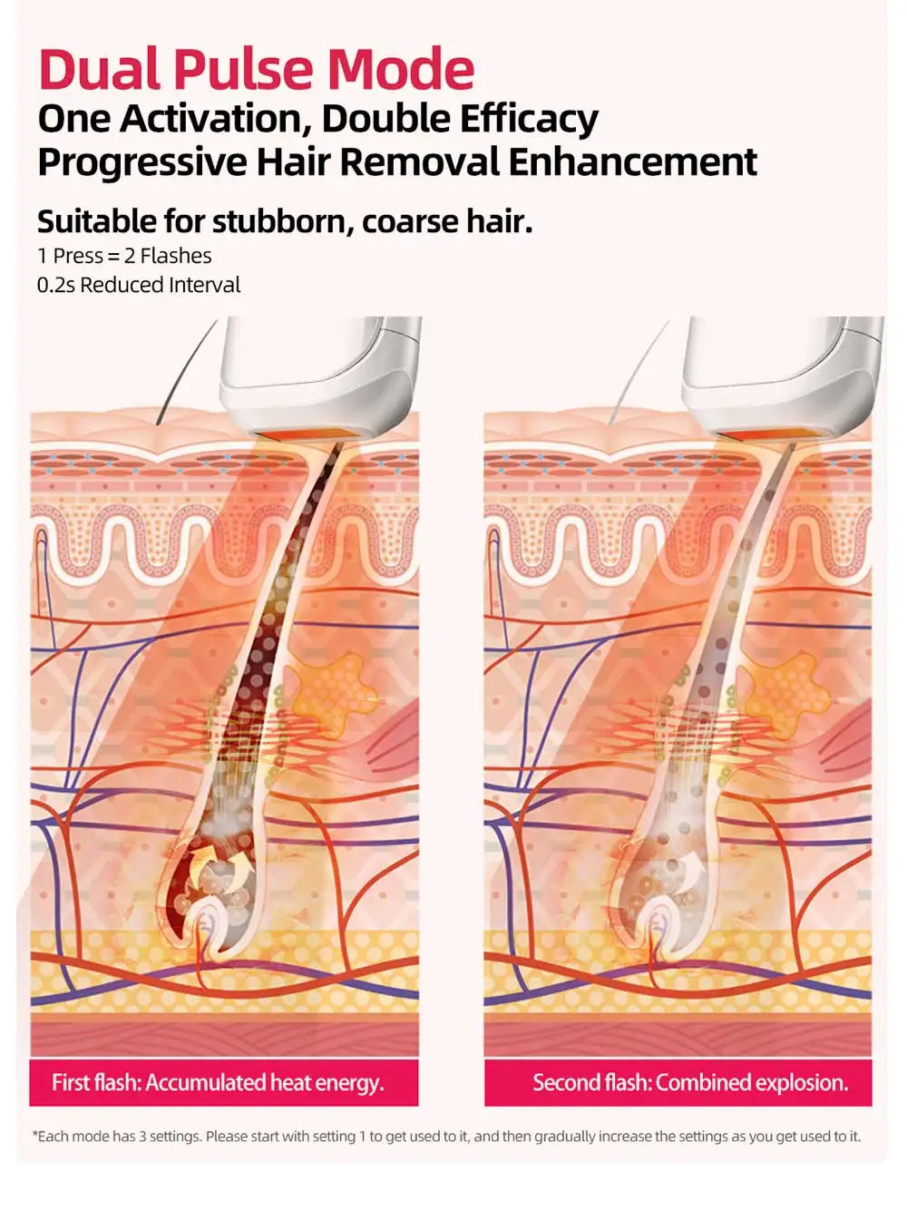 Diagram showing an IPL device using Dual Pulse mode to heat and target a hair follicle in two stages under the skin.