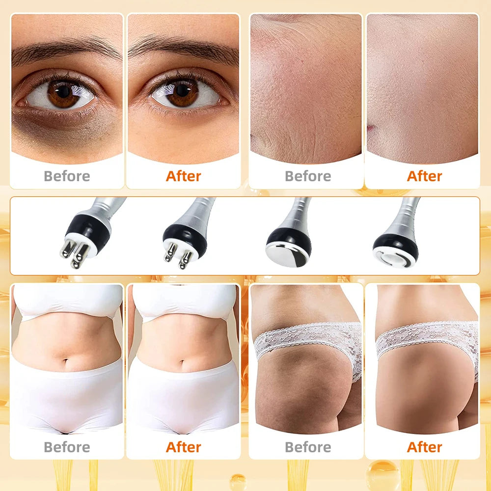 40K Cavitation Body Slimming Machine for Targeted Skin Tightening Body Shaping Massage Equipment Tidesmit