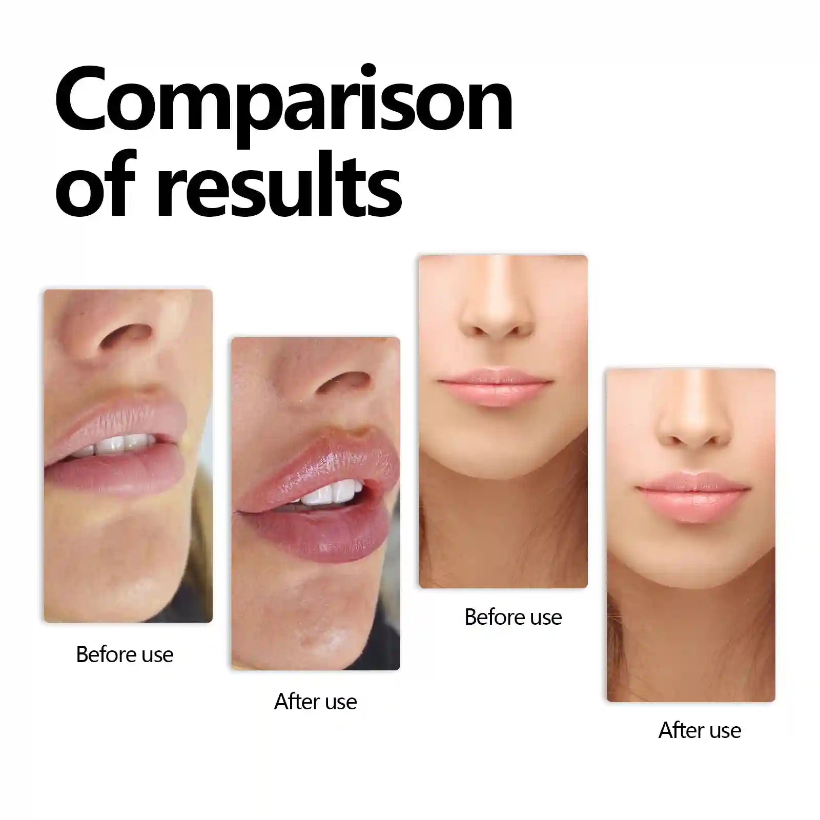Volumizing Lip Serum: Hydrating Plumper for Fuller, Nourished Lips Lip Care Tidesmit