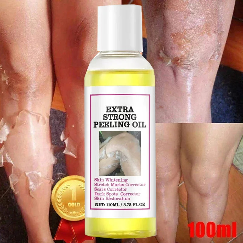 Yellow Peeling Oil for Dark Skin - Salon-Quality 100ml Exfoliating Treatment Scrubs Treatments Tidesmit
