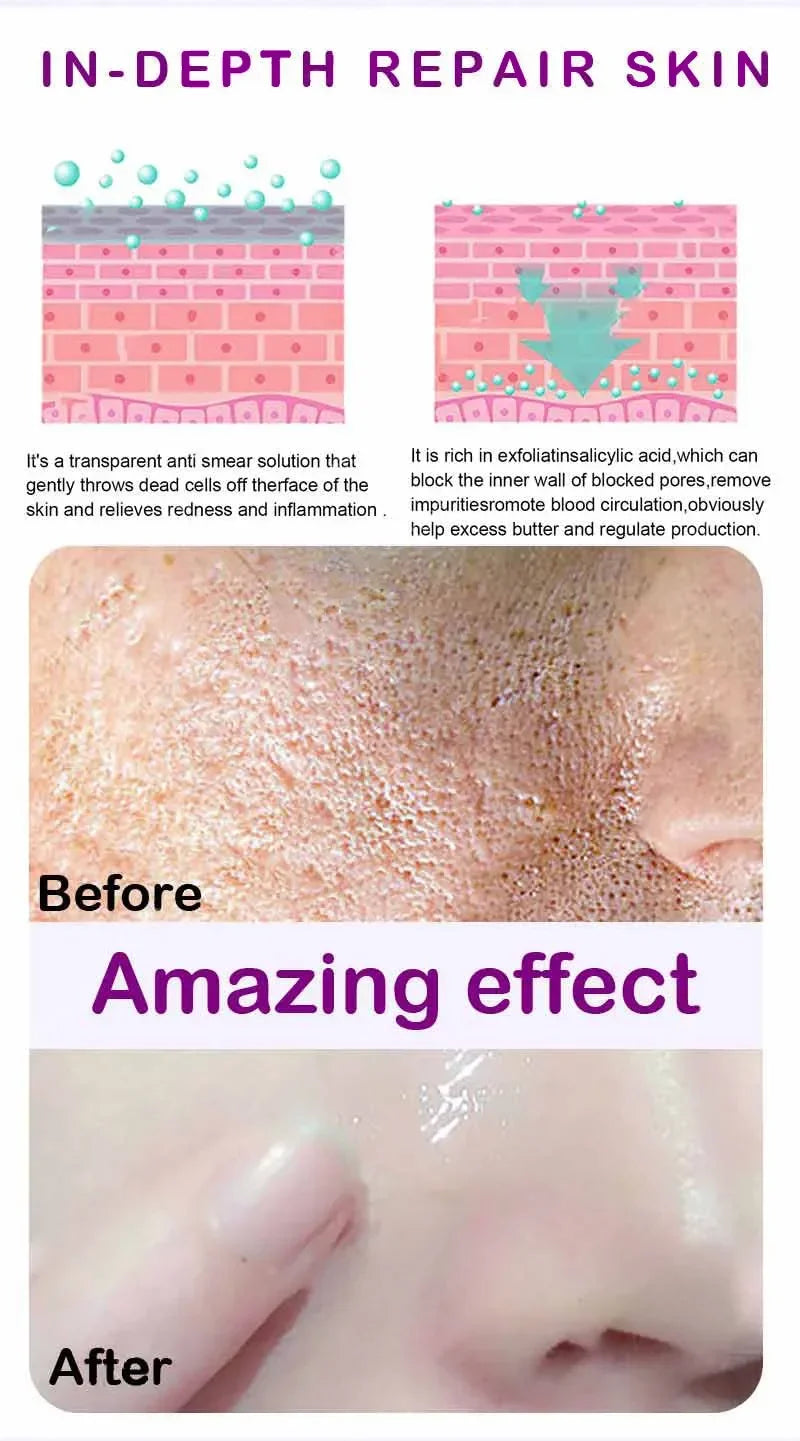 Retinol Niacinamide Serum - Professional PMU Machine Pore Refining Permanent Makeup Machines Tidesmit