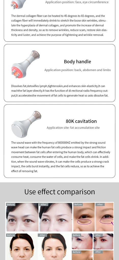 80K Ultrasonic Body Shaping Machine for Targeted Skin Firming & Contouring Body Shaping Massage Equipment Tidesmit