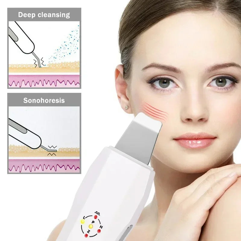 Ultrasonic Skin Scrubber | Deep Pore Cleaning Tool | USB Rechargeable Scrubs Treatments Tidesmit
