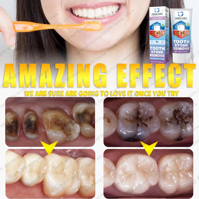 Tooth Decay Repair Treatment | Natural Deep Cleaning & Restorative Formula Scrubs Treatments Tidesmit