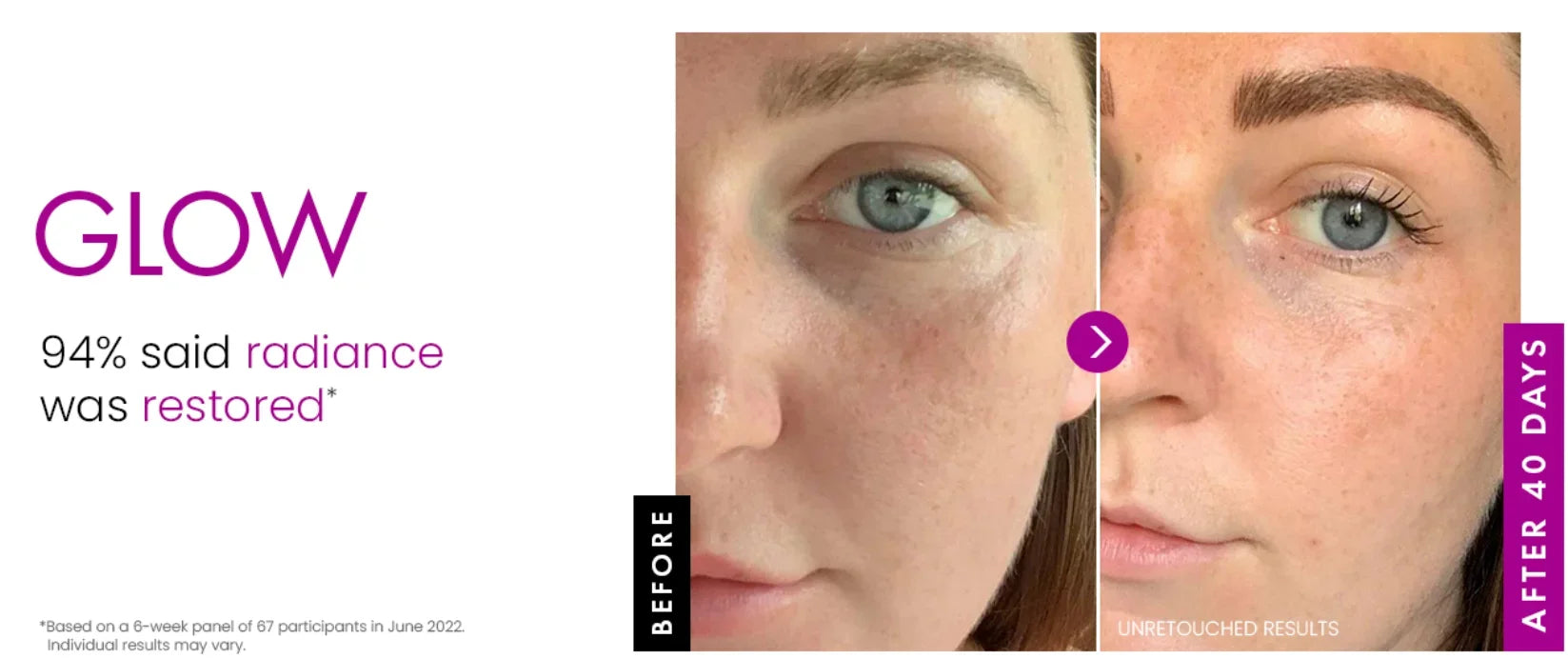 Before and after comparison of a person's face showing skin texture improvement after 40 days of using firming cream.