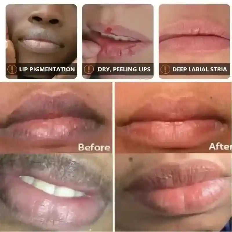 Dark Lip Lightening Balm - Exfoliating Pink Lip Mask by Tidesmit Lip Care Tidesmit