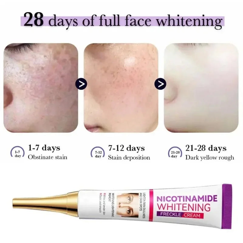 Tidesmit niacinamide melasma cream texture close-up for dark spot fading and facial brightening skincare