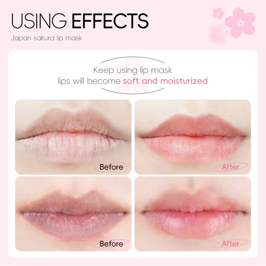 Hydrating Lip Mask Patches - Nourishing Gel Lip Care Treatment (10 Pack) Lip Care Tidesmit