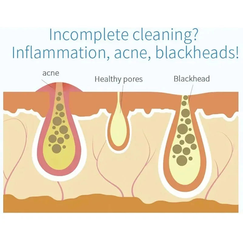 NEW Peeling Beauty Device New Small Bubble Oxygen Injection Instrument Hydra Dermabrasion Aqua Facial Cleaning Suction Blackhead