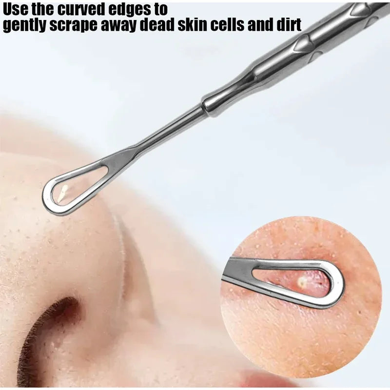 Blackhead Remover Tool Kit 4pc - Professional Stainless Steel Acne Set Scrubs Treatments Tidesmit