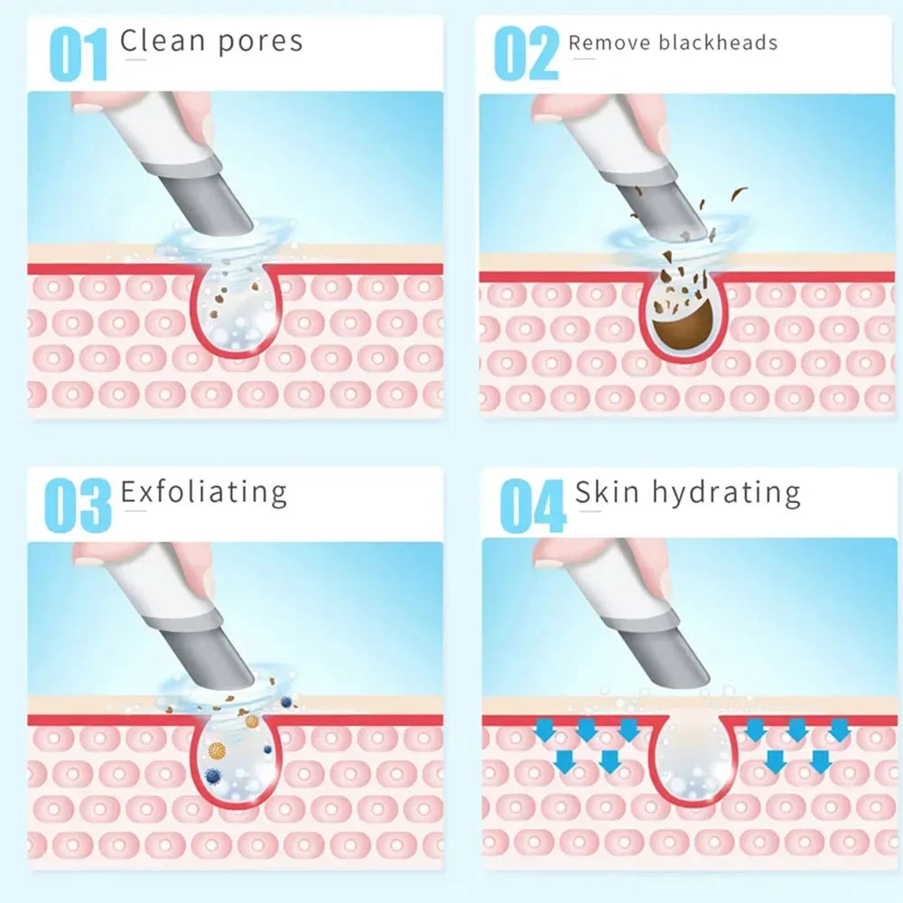 NEW Peeling Beauty Device New Small Bubble Oxygen Injection Instrument Hydra Dermabrasion Aqua Facial Cleaning Suction Blackhead