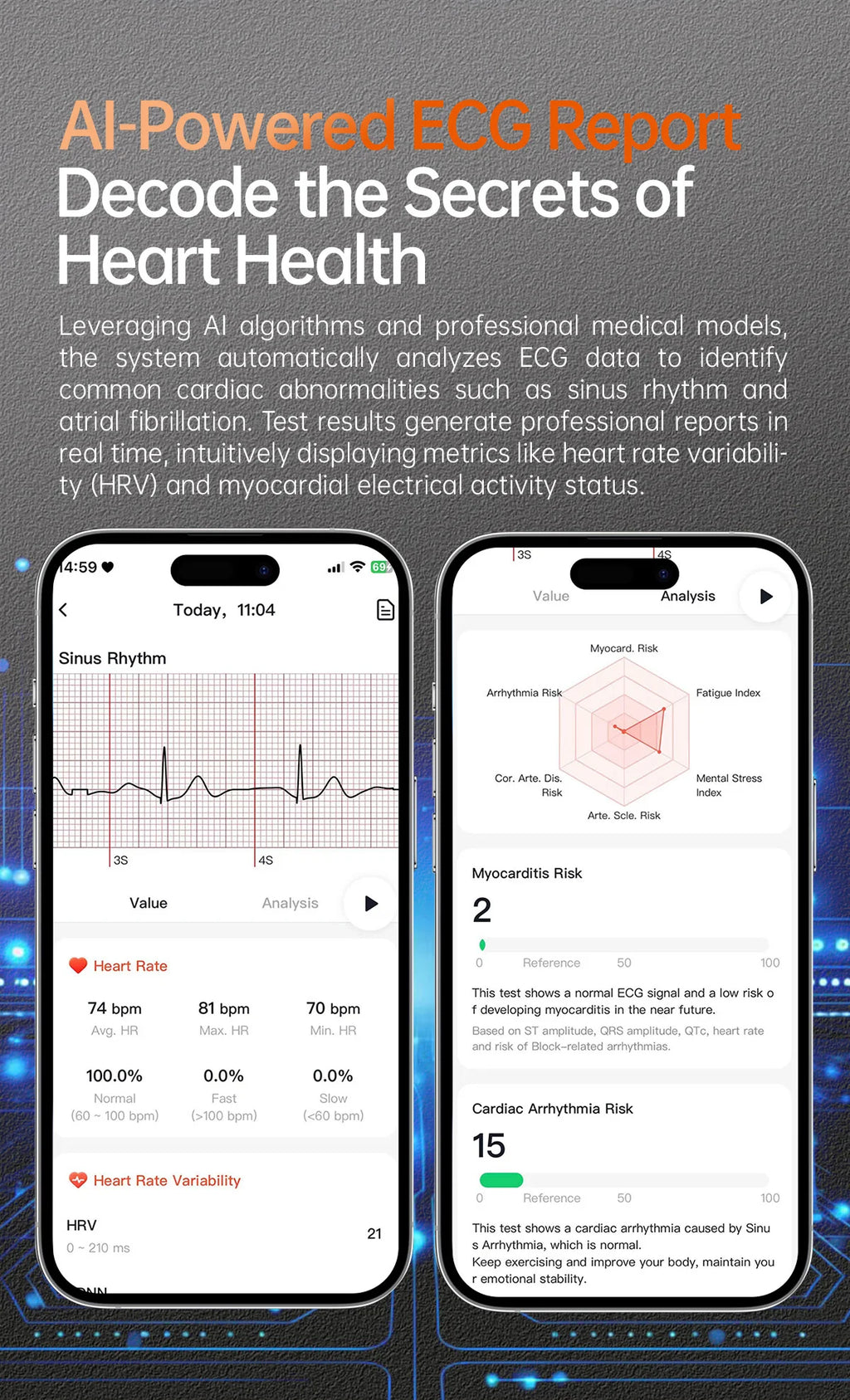 2026 New Health Analysis ECG+PPG Smart Watch Body Fat Uric Acid Blood Pressure Heart Rate Tracker NFC Smartwatch For Android IOS