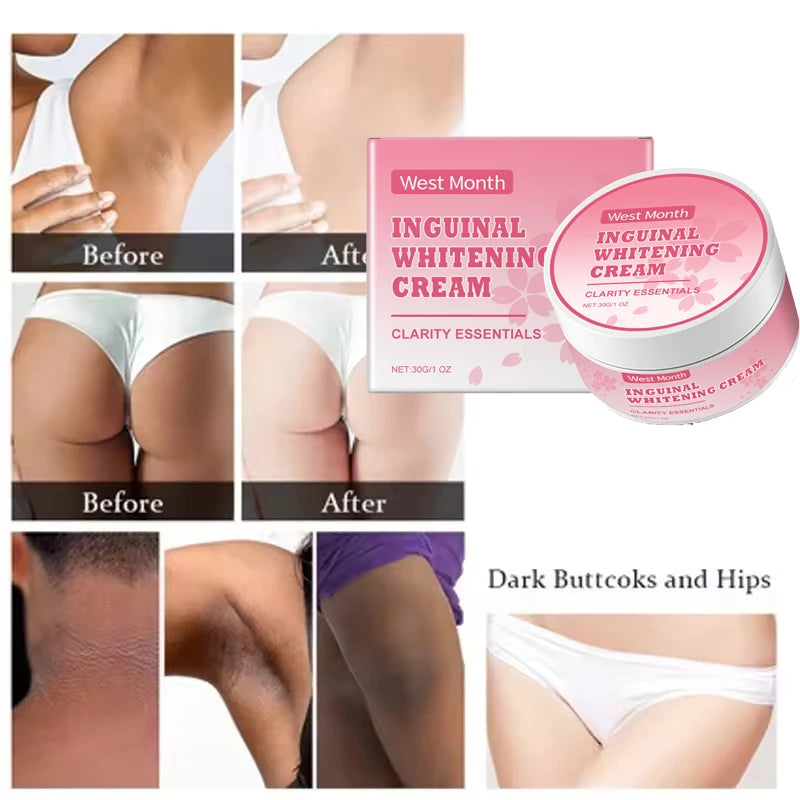 Body Whitening Niacinamide Brighten Cream For Intimate Parts Underarm Bleach Knees Lighten Thigh Inner Korean Skin Care Products
