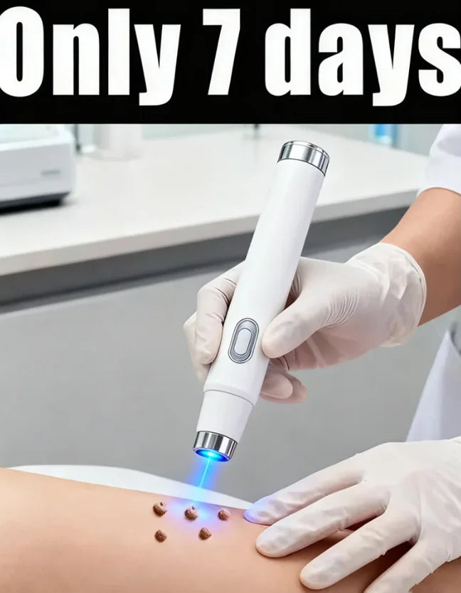 Blue Light Skin Care Tool for Warts – Portable Home Wellness Device Relaxation Treatment Buy 5 Get 5 Free Tidesmit