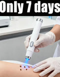 Blue Light Skin Care Tool for Warts – Portable Home Wellness Device Relaxation Treatment Buy 5 Get 5 Free Tidesmit