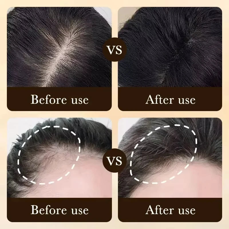 Tidesmit hair growth treatment: before and after results for hair loss, scalp nourishment, and hair regrowth.
