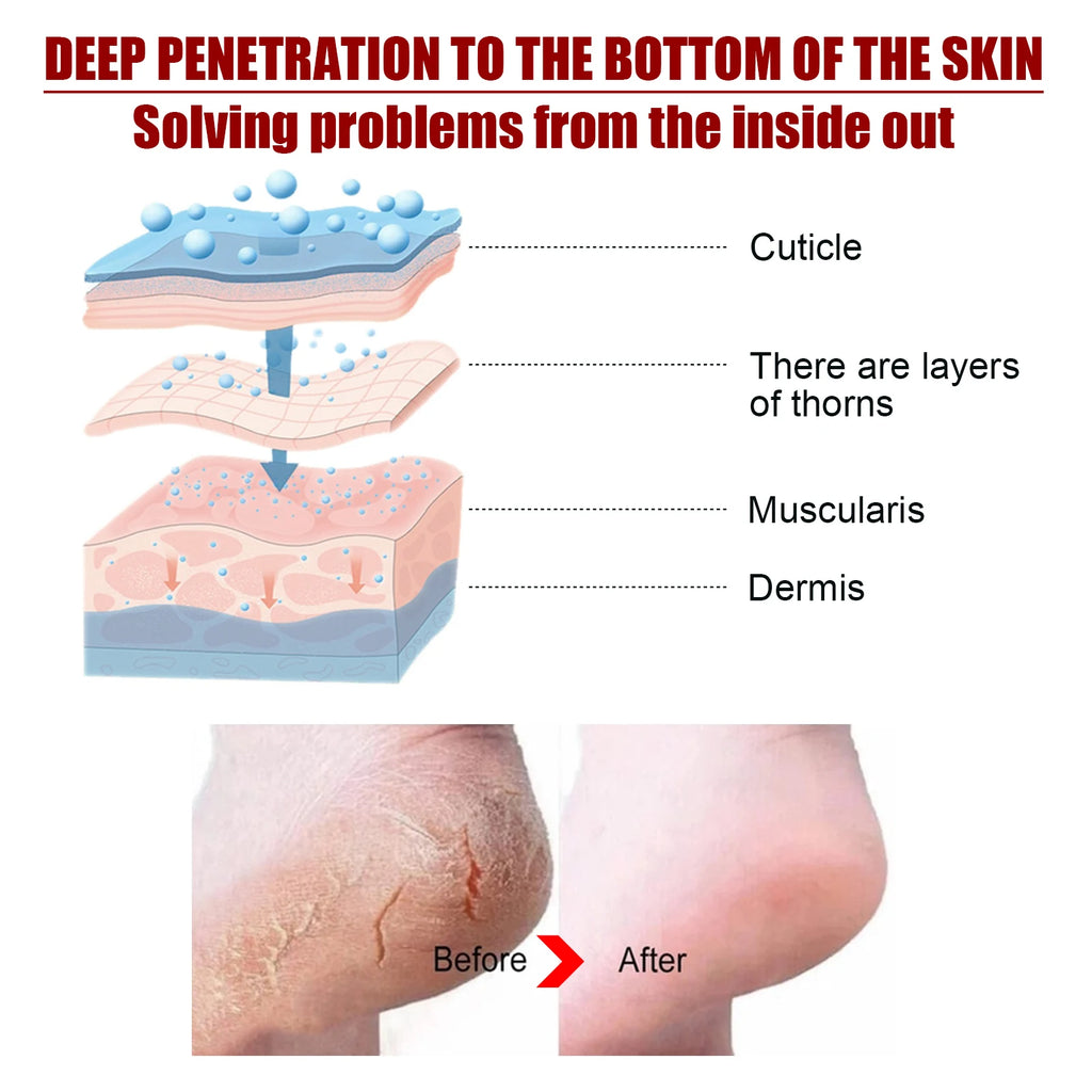 Exfoliating Foot Peel Mask - Apple Extract Callus Remover (5-15 Pack) Scrubs Treatments Tidesmit