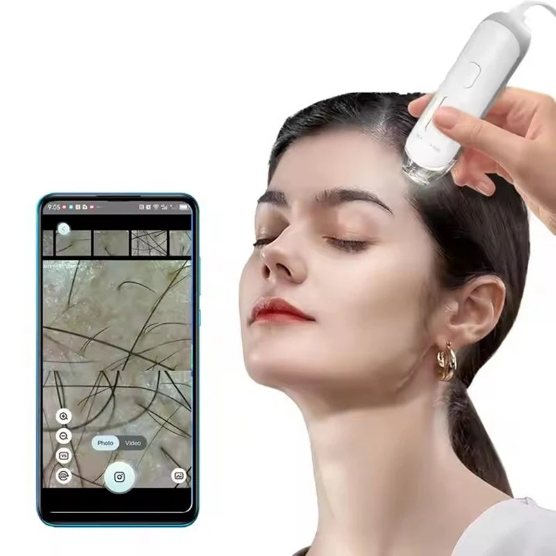 Digital HD skin and hair scalp detector with 50X-200X magnification, showing live diagnostic imaging on smartphone.