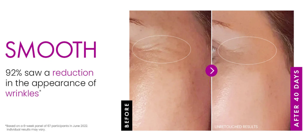 Before and after comparison of skin texture showing reduced eye wrinkles after 40 days of anti-aging cream use.