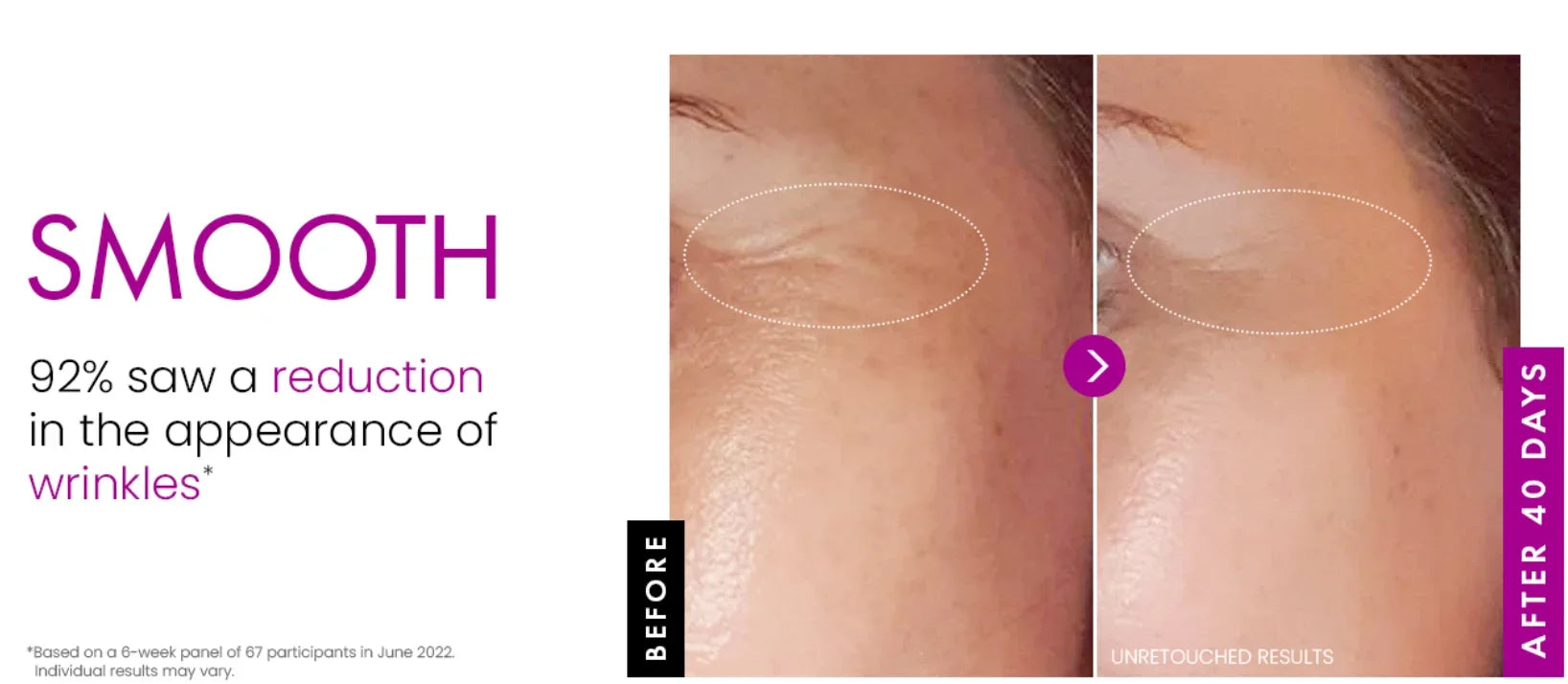 Before and after comparison of skin texture showing reduced eye wrinkles after 40 days of anti-aging cream use.