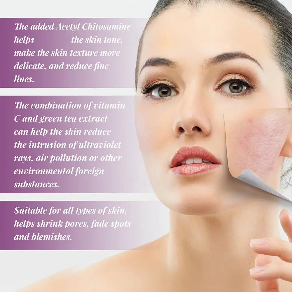Niacinamide Serum 20% High Concentration Formula Serum Brightens Lightens Spots Niacinamide Care Serum Lifts Nasal Lines