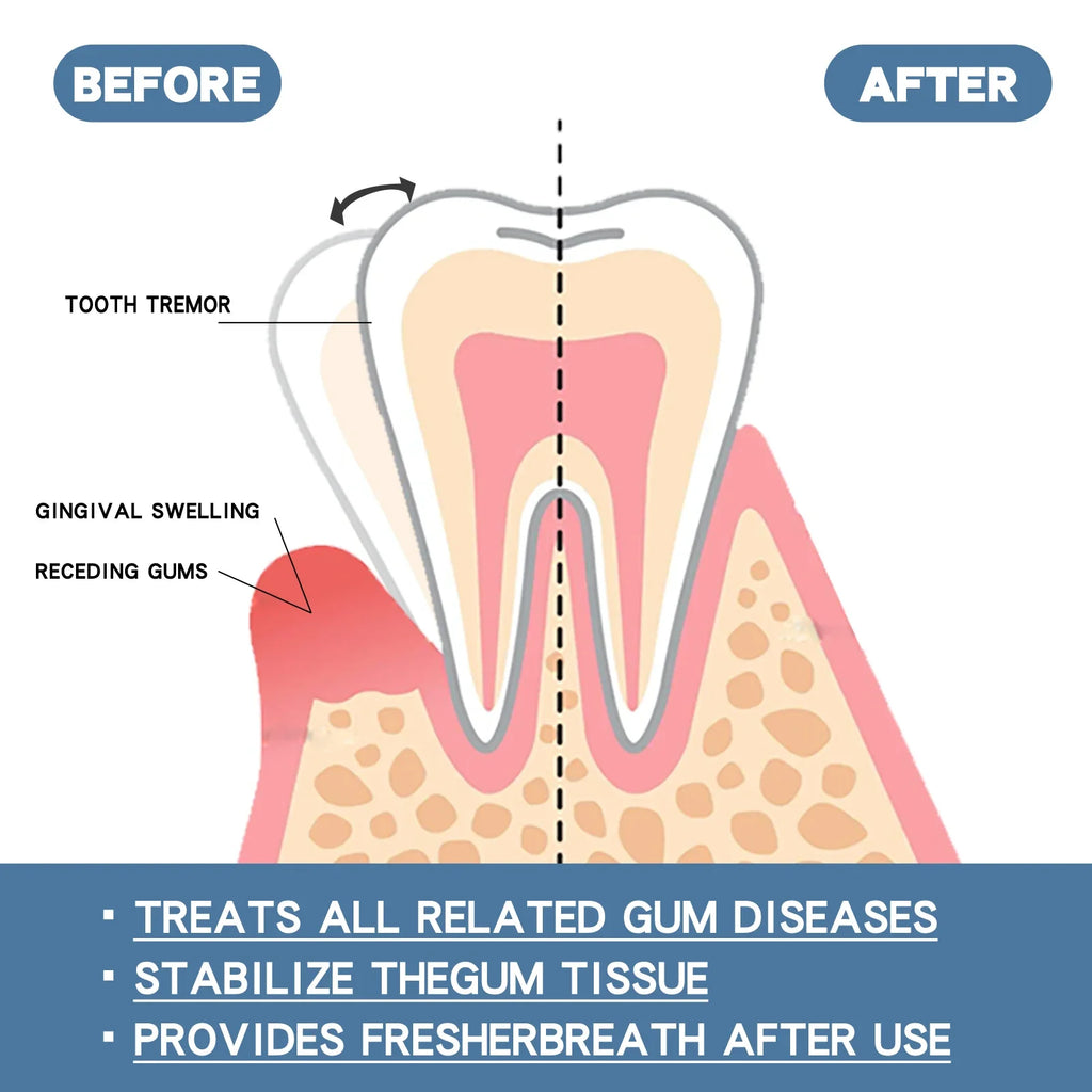 Tidesmit gum repair and teeth whitening toothpaste for pain relief and professional oral care