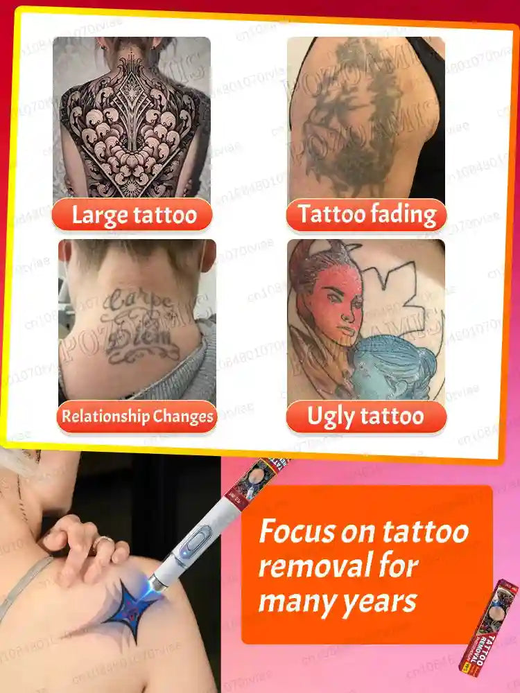 Tattoo Removal Cream for Body and Face - Professional Fast Action Formula Scrubs Treatments Tidesmit