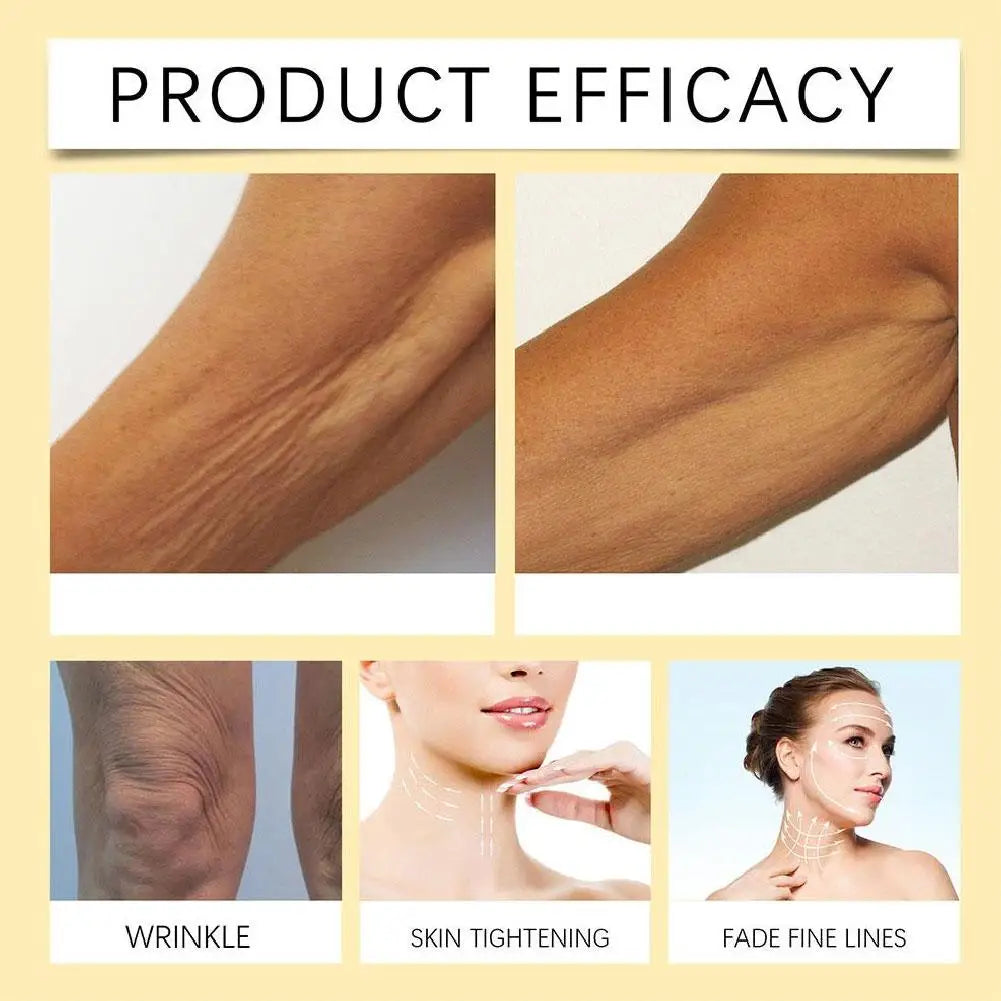 Before-and-after comparison showing skin tightening and wrinkle reduction on arms, neck, and face.