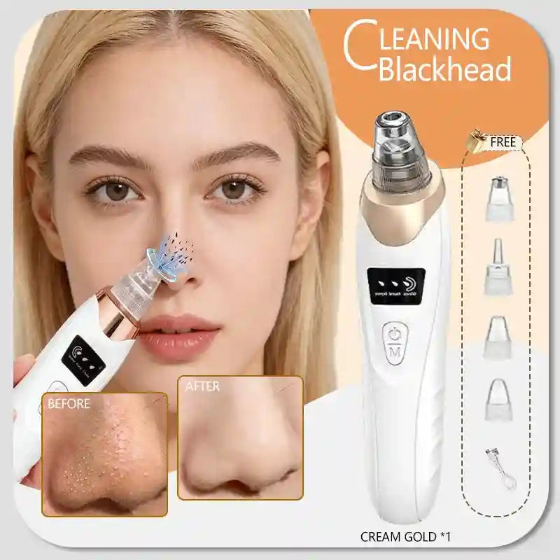 White and gold rechargeable blackhead vacuum pore extractor with suction tips for facial cleansing and skin care.