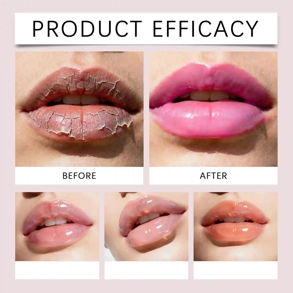 Hydrating Lip Serum: Plumping & Smoothing Lip Treatment | Tidesmit Lip Care Tidesmit