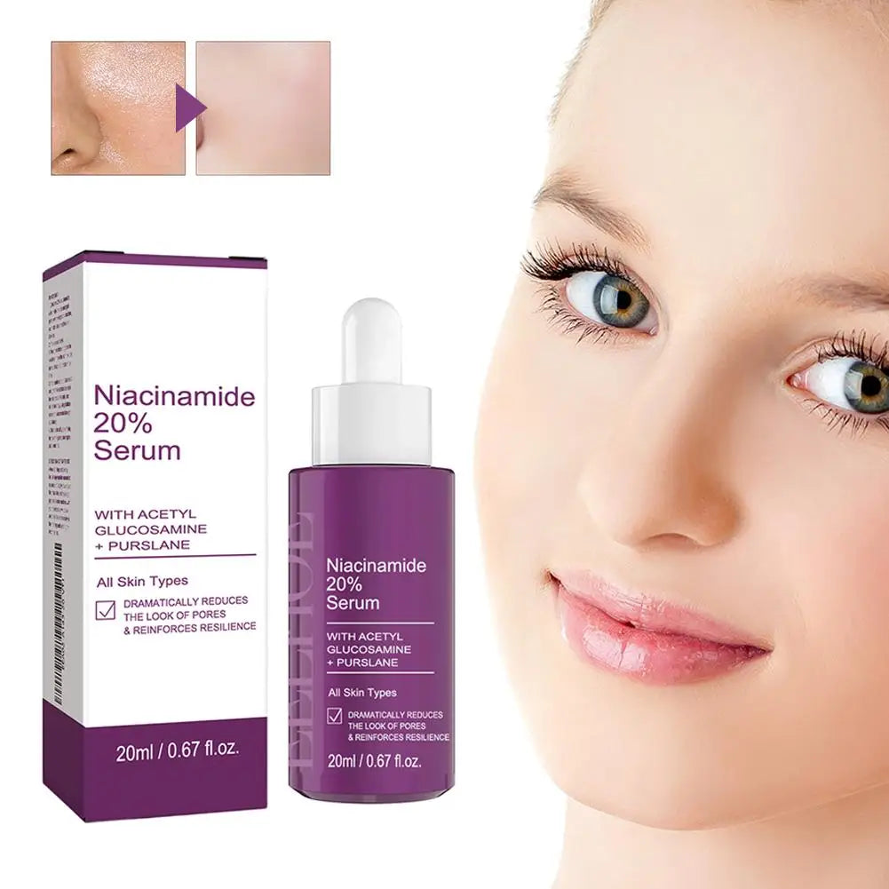 Niacinamide Serum 20% High Concentration Formula Serum Brightens Lightens Spots Niacinamide Care Serum Lifts Nasal Lines