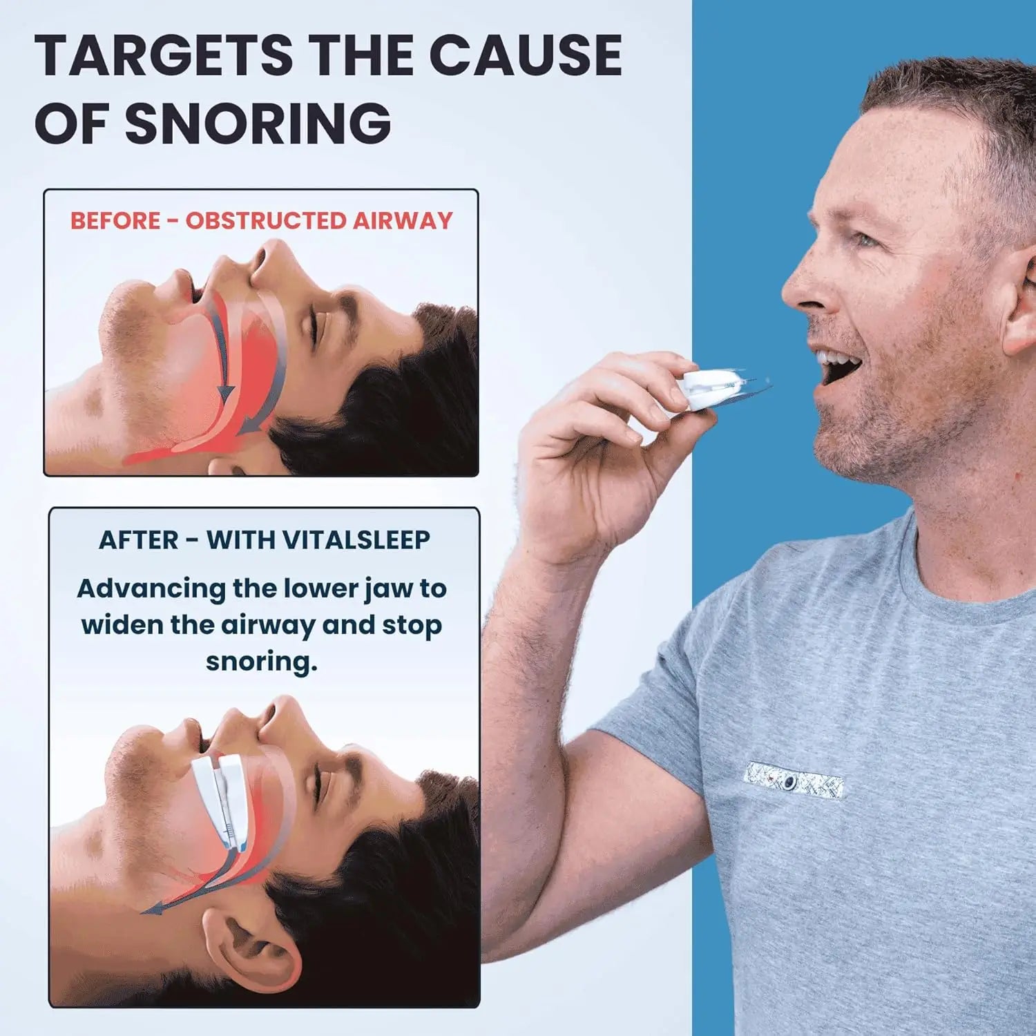 Anti-Snoring Mouthpiece Anti-Snoring Device Night Time Teeth Mouthguard Adjustable Sleeping Mouth Guard for Bruxism Stop Snoring