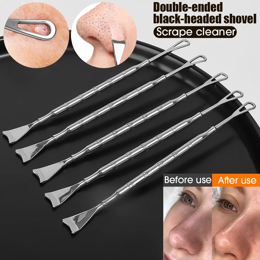 Blackhead Remover Tool Kit 4pc - Professional Stainless Steel Acne Set Scrubs Treatments Tidesmit