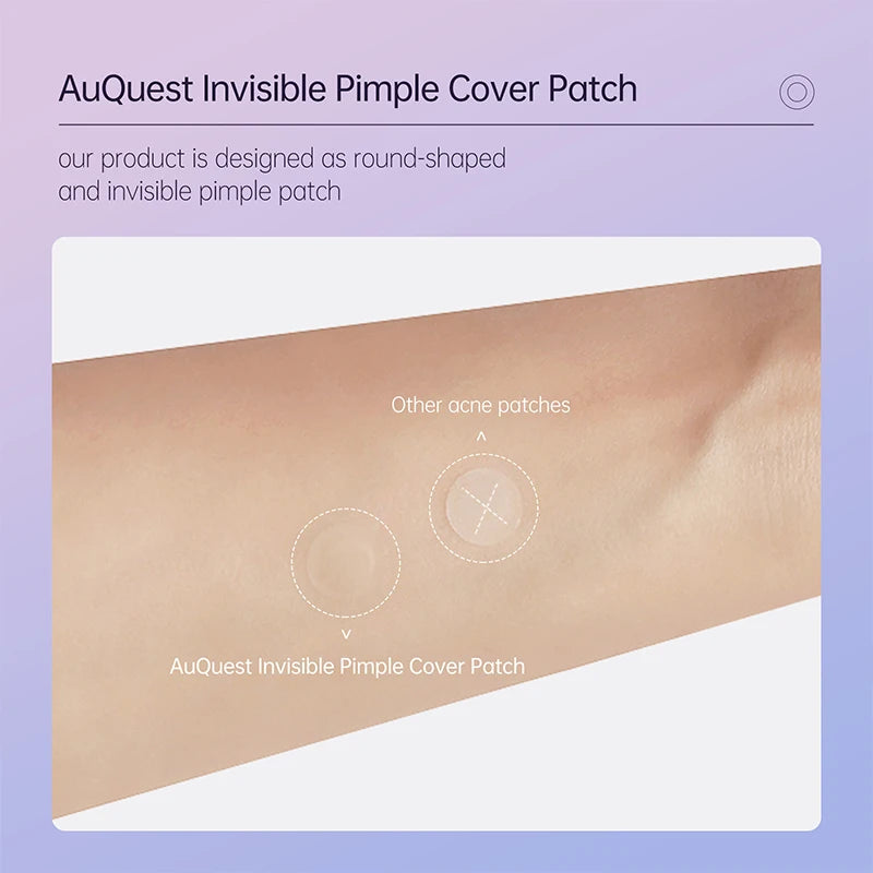 36pcs Hydrocolloid Acne Patches Absorb Pus & Oil, Reduce Redness, Invisible Fit for All-Day Wear Spot Stickers for Face and Body