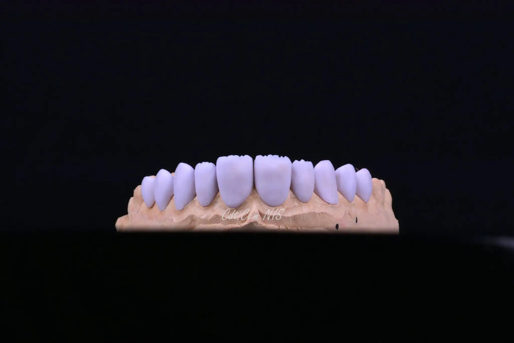 30PCS Lodden Lithium Disilicate C14 Dental Lab Glass-matrix Ceramics Block Chairside Restoration Aesthetics Materials Wholesale