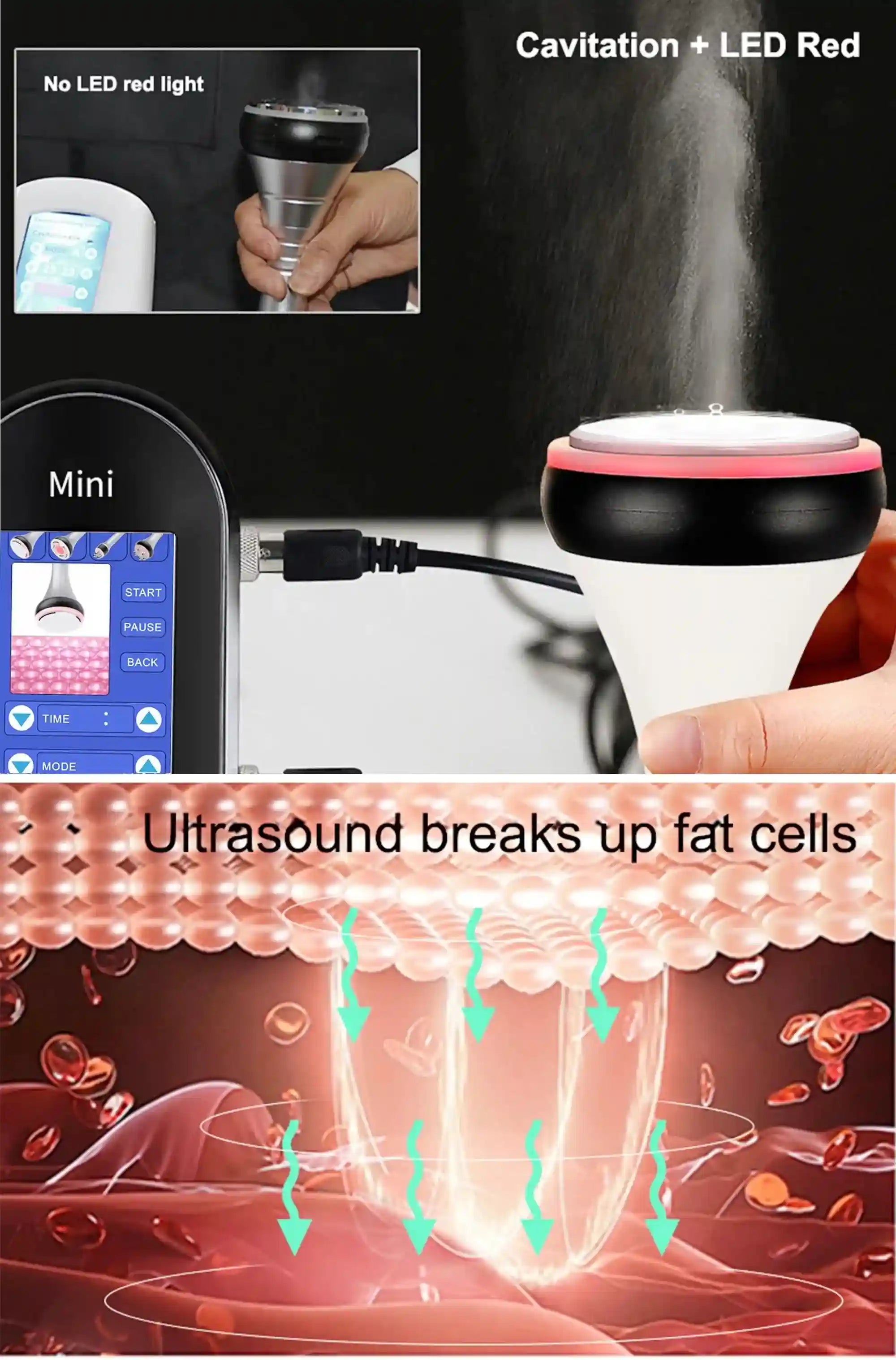 Ultrasonic Cavitation Machine for Body Slimming & Muscle Relief Eye Massage Instrument Tidesmit