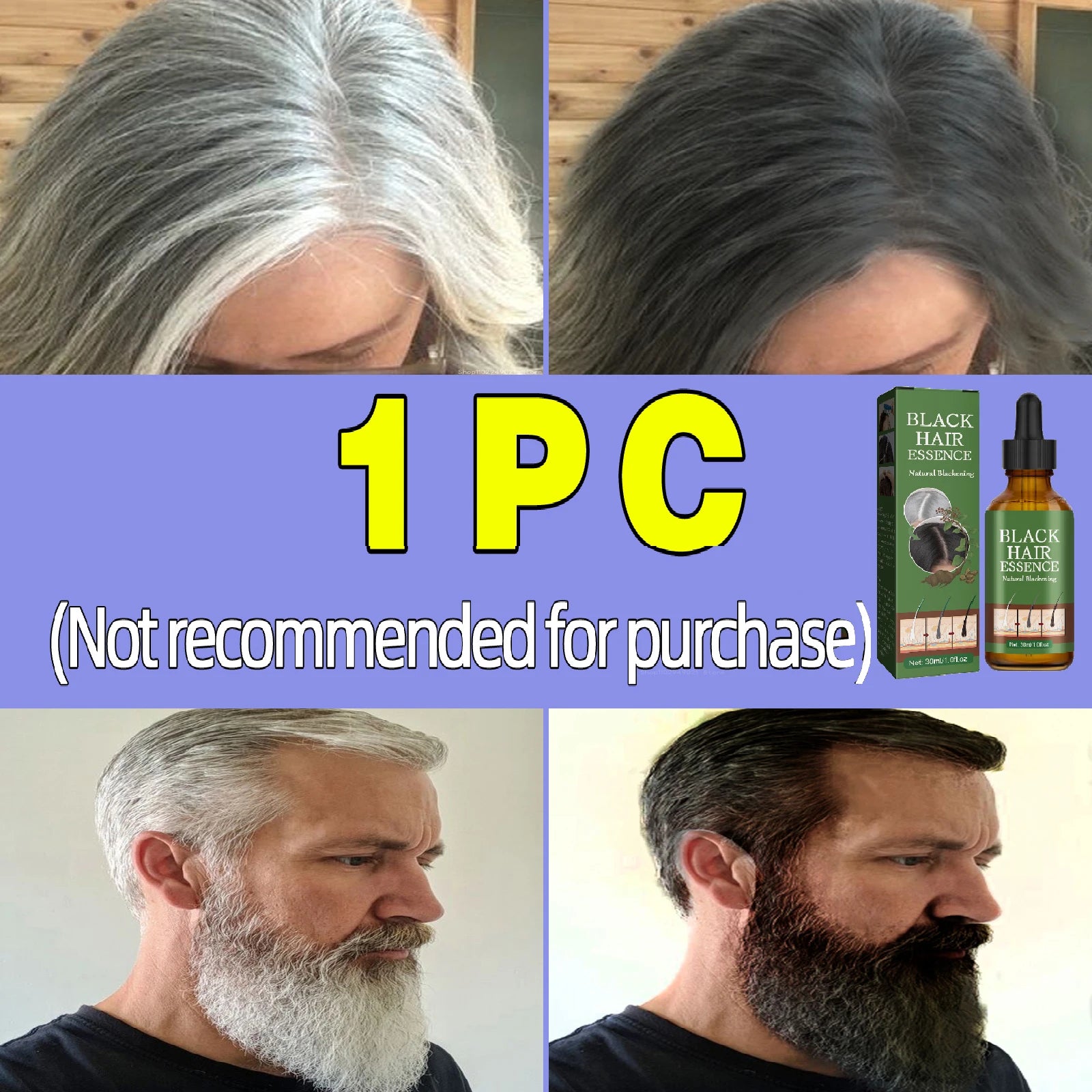 Anti Gray Hair Serum – Natural Scalp Nourishing Darkening Care Lip Care 1 pcs Tidesmit