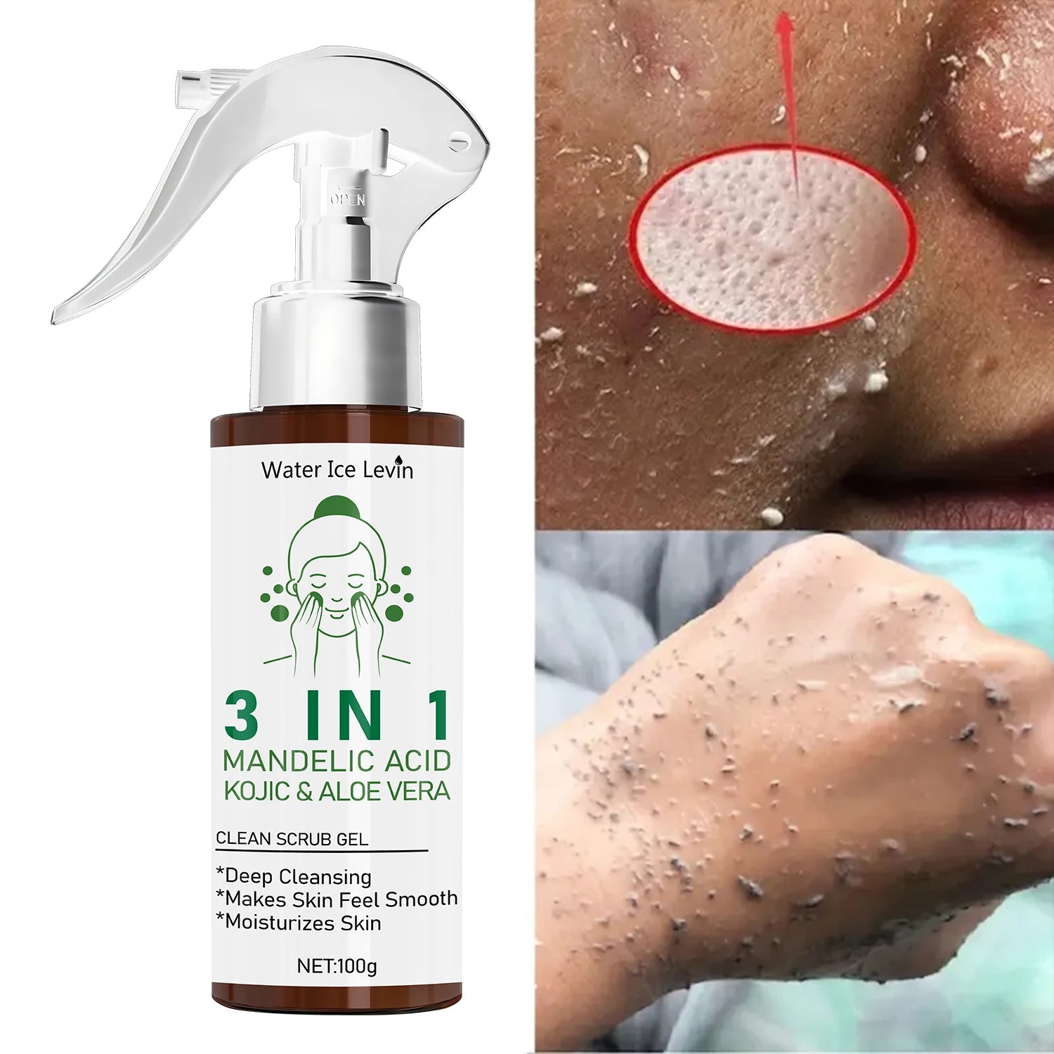Mandelic Acid Kojic Acid Scrub Gel 100g | Deep Pore Cleansing Treatment Scrubs Treatments Tidesmit