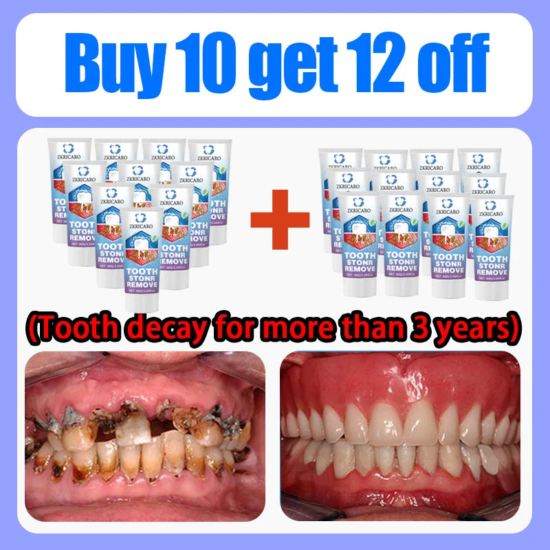 Teeth Whitening Scrub Paste | Deep Cleaning Dental Treatment Scrubs Treatments Buy 10 Get 12 Free Tidesmit