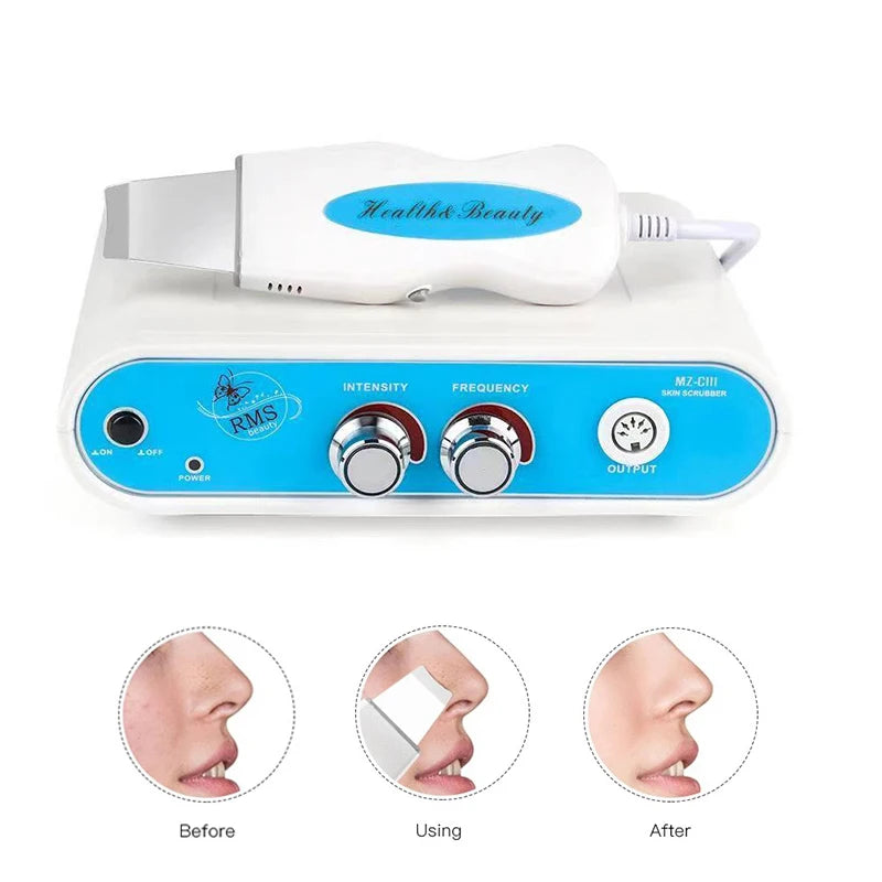 Ultrasonic Skin Scrubber Facial Cleanser - Professional Pore Exfoliator Scrubs Treatments Tidesmit