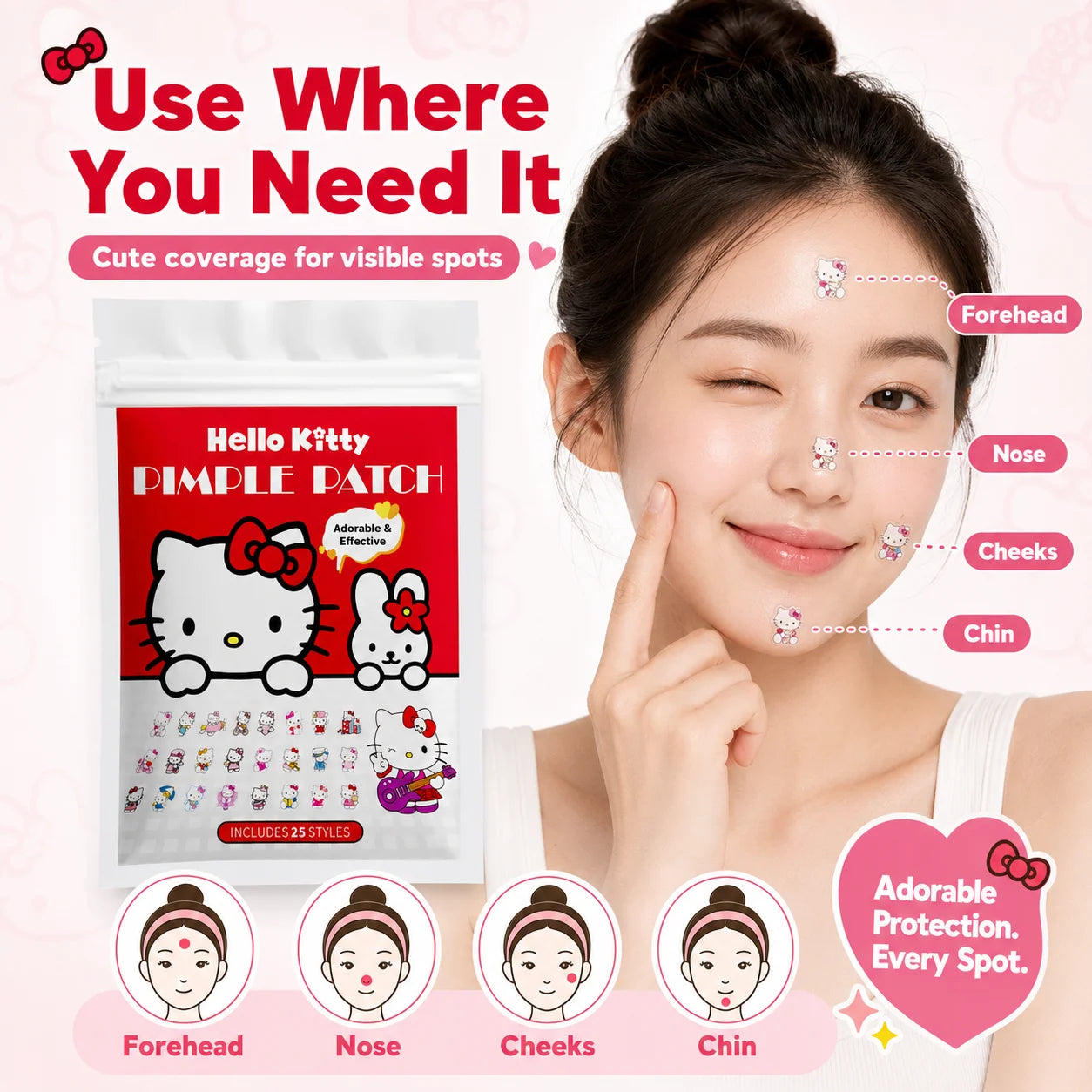 125PCS Sanrio Hello Kitty Acne Patch, Hydrocolloid Acne Patch, Makeup Blemish Pimple Patch, Waterproof and Sweatproof