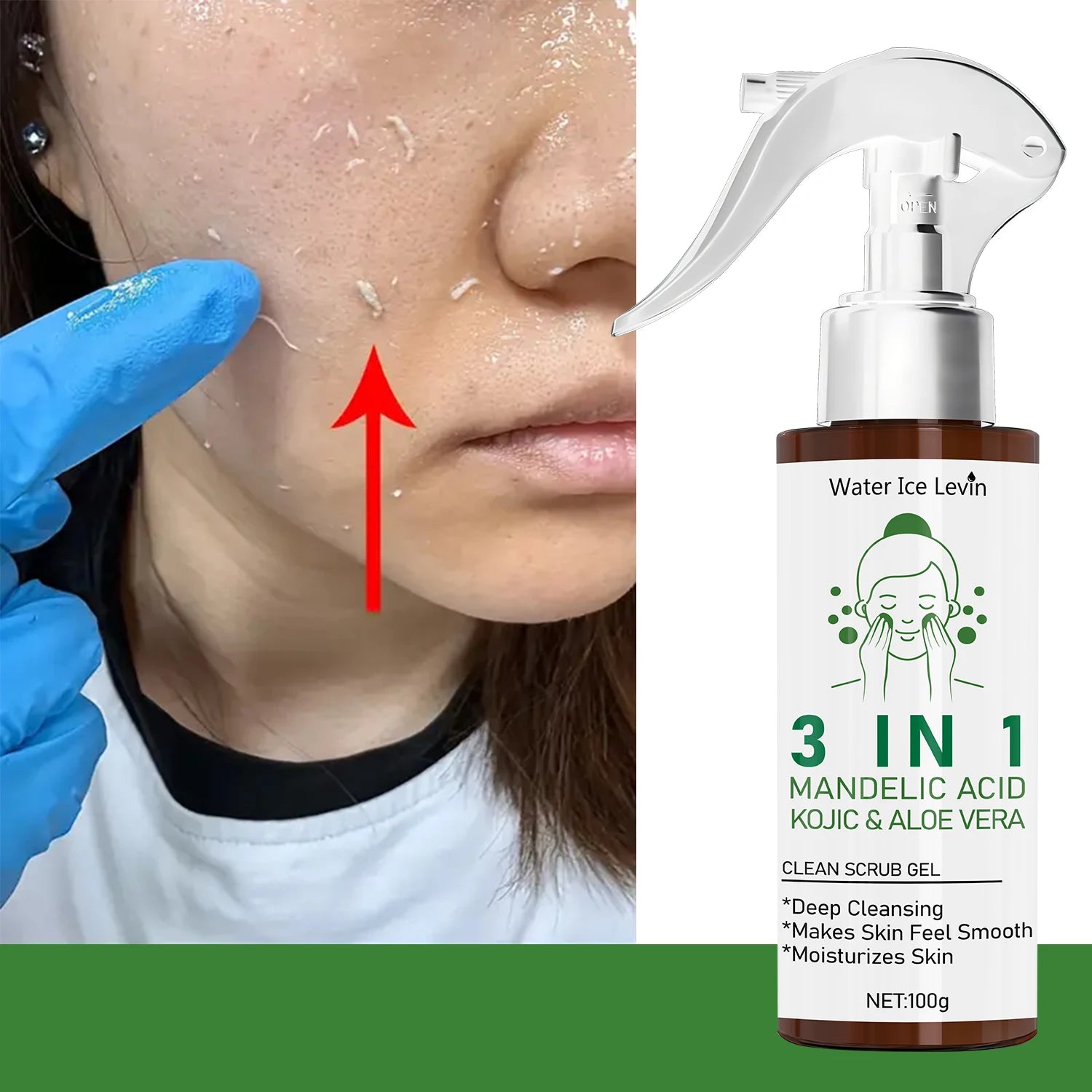 Mandelic Acid Kojic Acid Scrub Gel 100g | Deep Pore Cleansing Treatment Scrubs Treatments Tidesmit