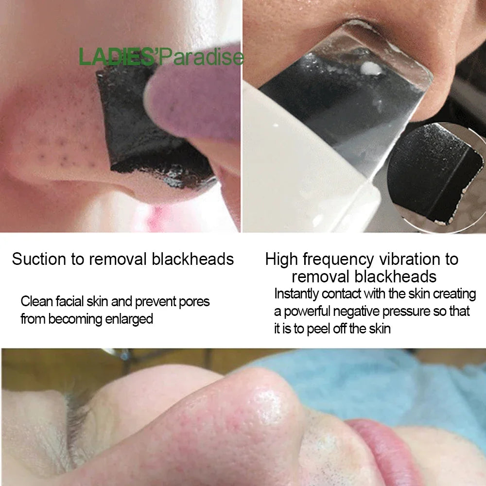 Ultrasonic Facial Skin Scrubber | Deep Pore Exfoliator & Spa Tool Scrubs Treatments Tidesmit