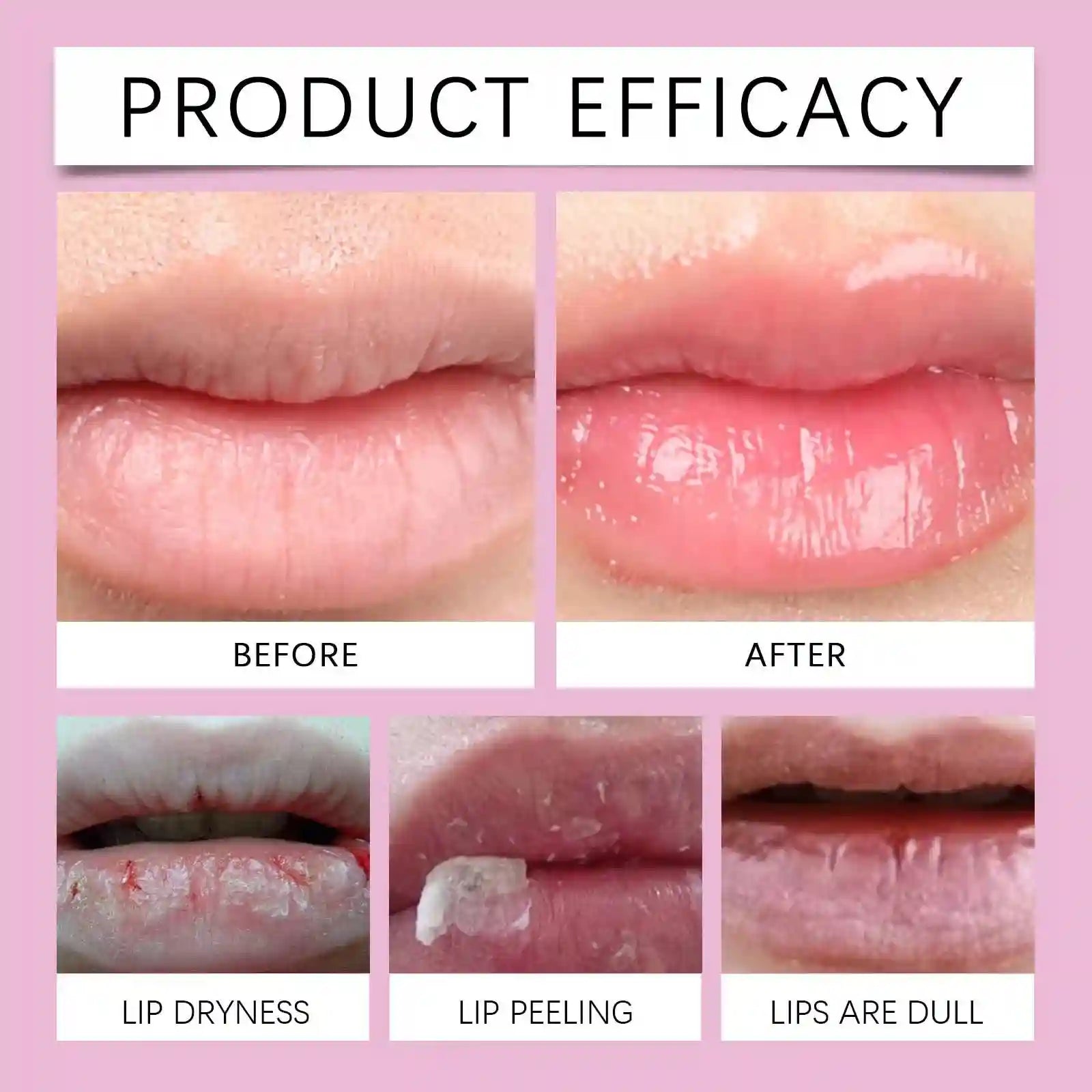Lip Plumper Serum | Instant Hydrating Lip Treatment for Fuller Lips Lip Care Tidesmit